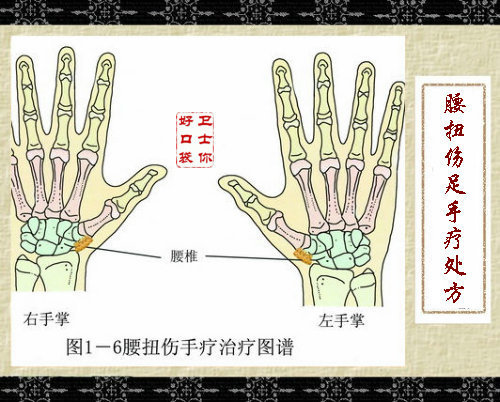 腰扭傷手療處方