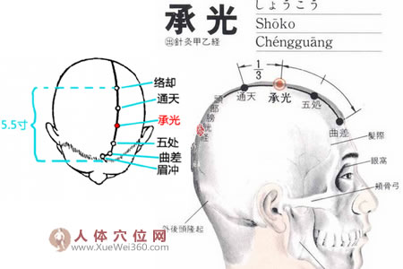 承光穴