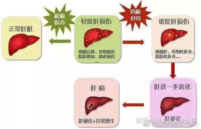 慢性肝炎癥狀(急性慢性肝炎癥狀)