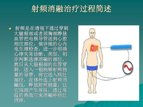 射頻熱凝消融術(shù)副作用(射頻熱凝消融術(shù)副作用大嗎)