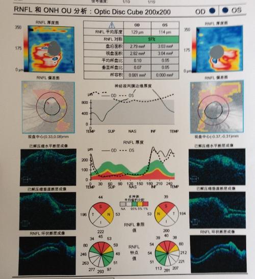 oct檢查有沒有副作用_oct檢查有沒有副作用啊