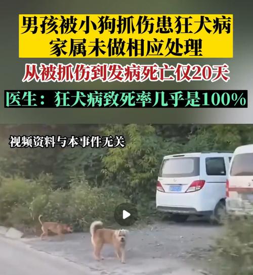 人得狂犬病的癥狀-人得狂犬病的癥狀前兆可以治愈嗎