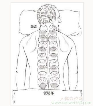 抑郁、煩悶別著急，用火罐拔走