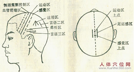 中風(fēng)的推拿治療技術(shù)