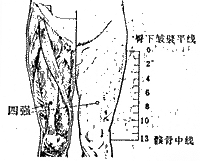 四強(qiáng)穴