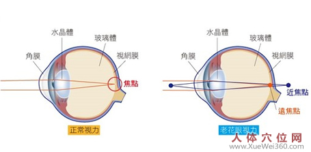 用針刺激手腕穴位使85歲老人摘掉了老花鏡